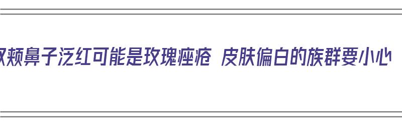 双颊鼻子泛红可能是玫瑰痤疮 皮肤偏白的族群要小心（鼻子发红是玫瑰痤疮吗）