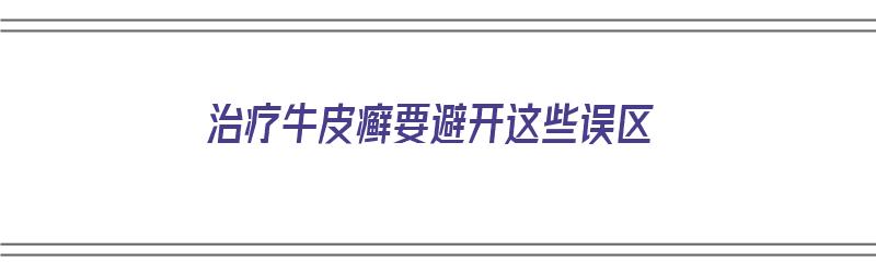 治疗牛皮癣要避开这些误区