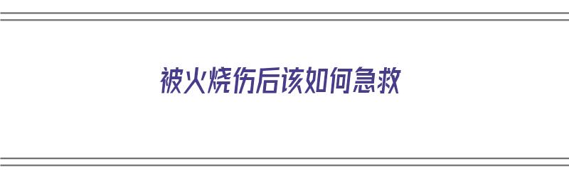 被火烧伤后该如何急救（被火烧伤后该如何急救呢）