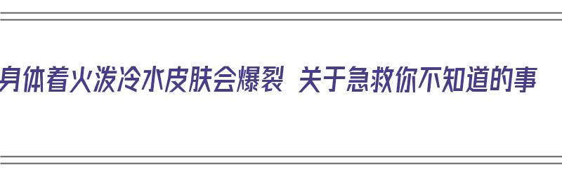 身体着火泼冷水皮肤会爆裂 关于急救你不知道的事